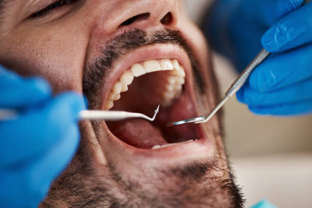 Best Emergency Treatment for Oral Infections in Onawa, IA